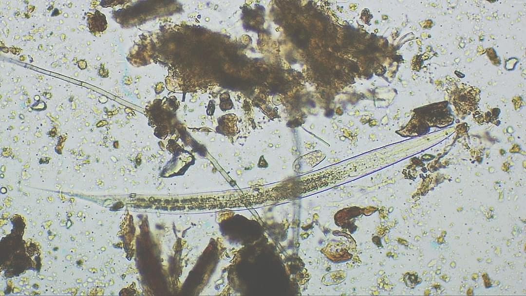 Load video: Worm Casting Microbiology Video