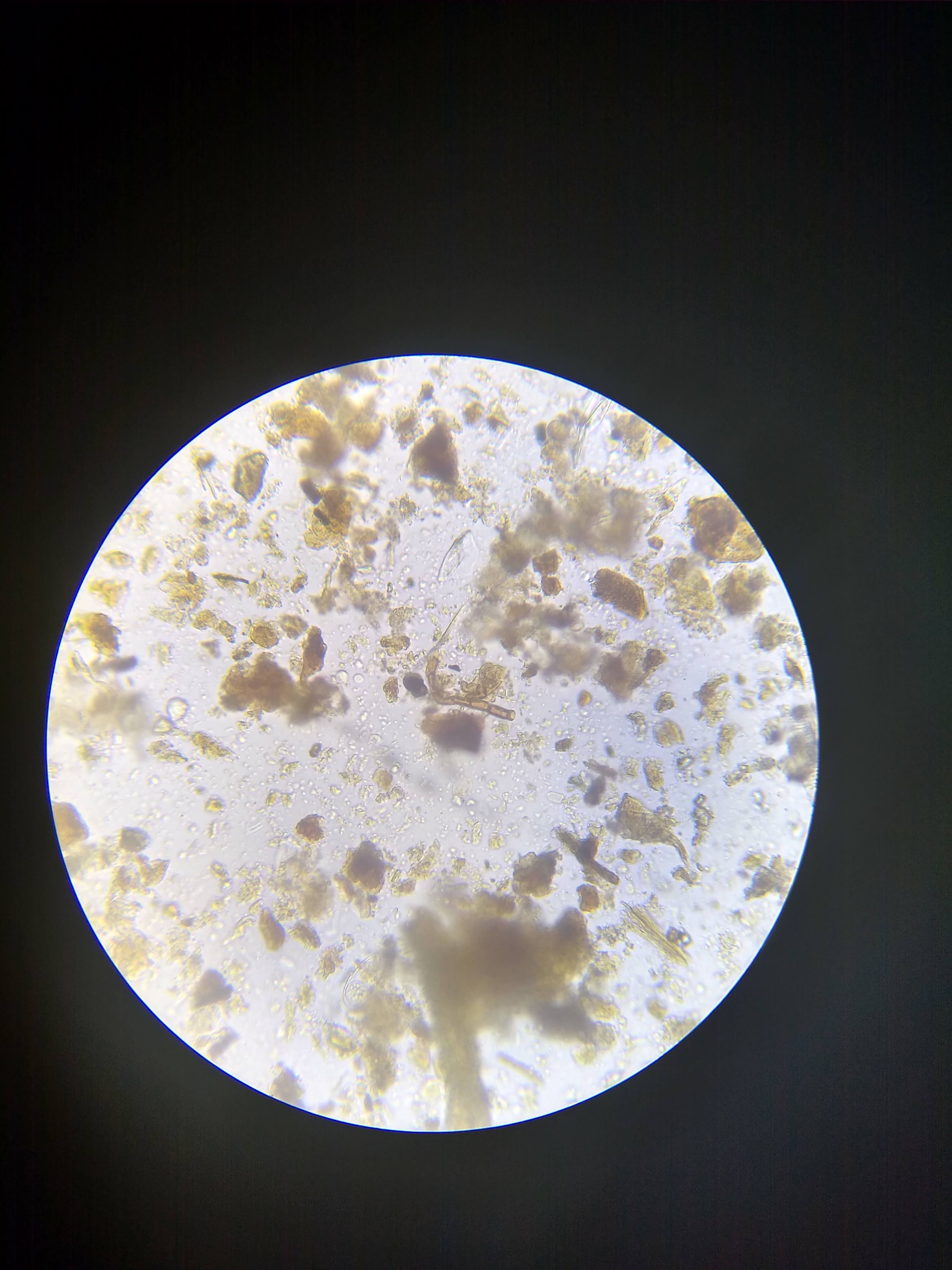 Fungal Hyphae under Microscope